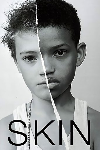 Póster de Skin